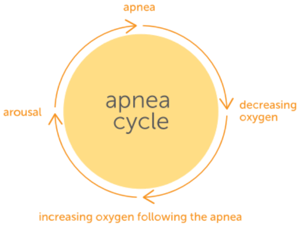 sleep-cycle